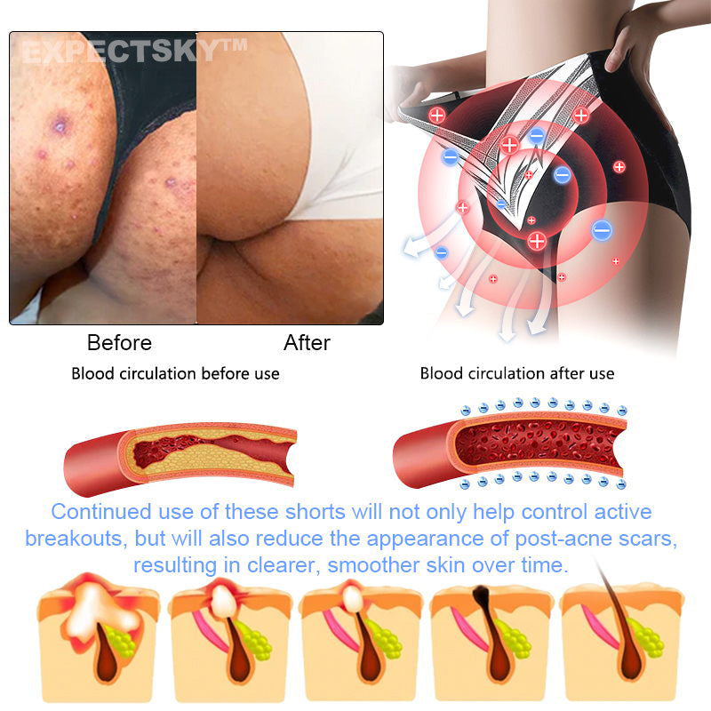 Medical Grade Titanium Fiber Self-heating Tourmaline Shaping Shorts💥