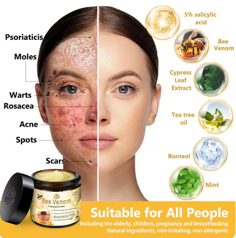 Bee Venom Skin Treatment Cream Royal Pharmaceutical Society (RPS) Approved(Helping with acne, wart, rosacea, psoriasis, age spots, eczema, and reducing the appearance of stretch marks) 🌳