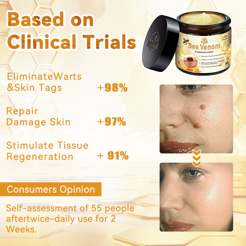 Bee Venom Skin Treatment Cream Royal Pharmaceutical Society (RPS) Approved(Helping with acne, wart, rosacea, psoriasis, age spots, eczema, and reducing the appearance of stretch marks) 🌳